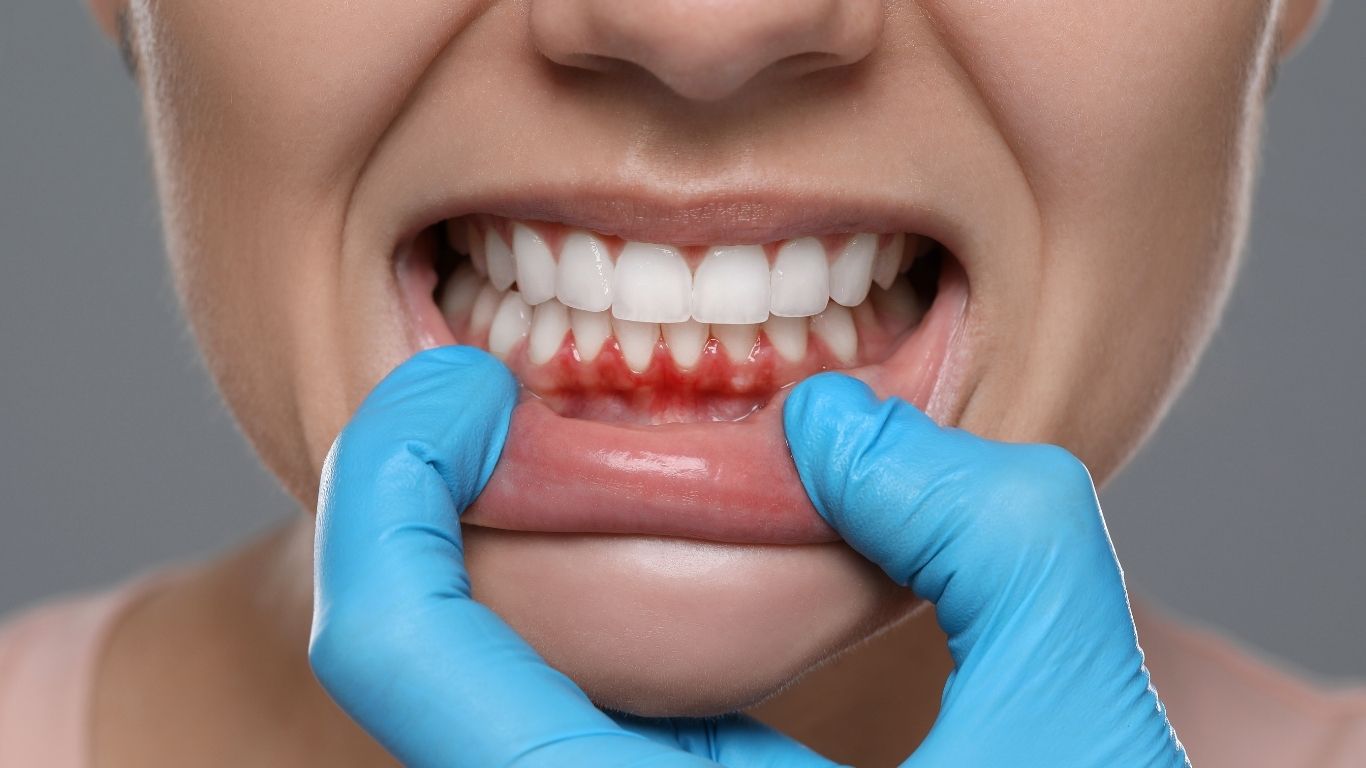 How to Take Care of Your Gums