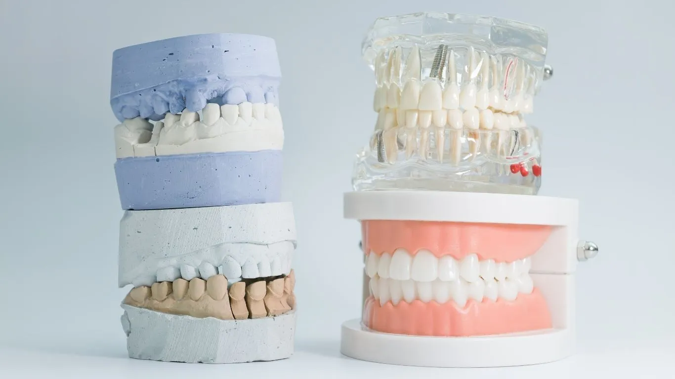 Types of Dental Implants
