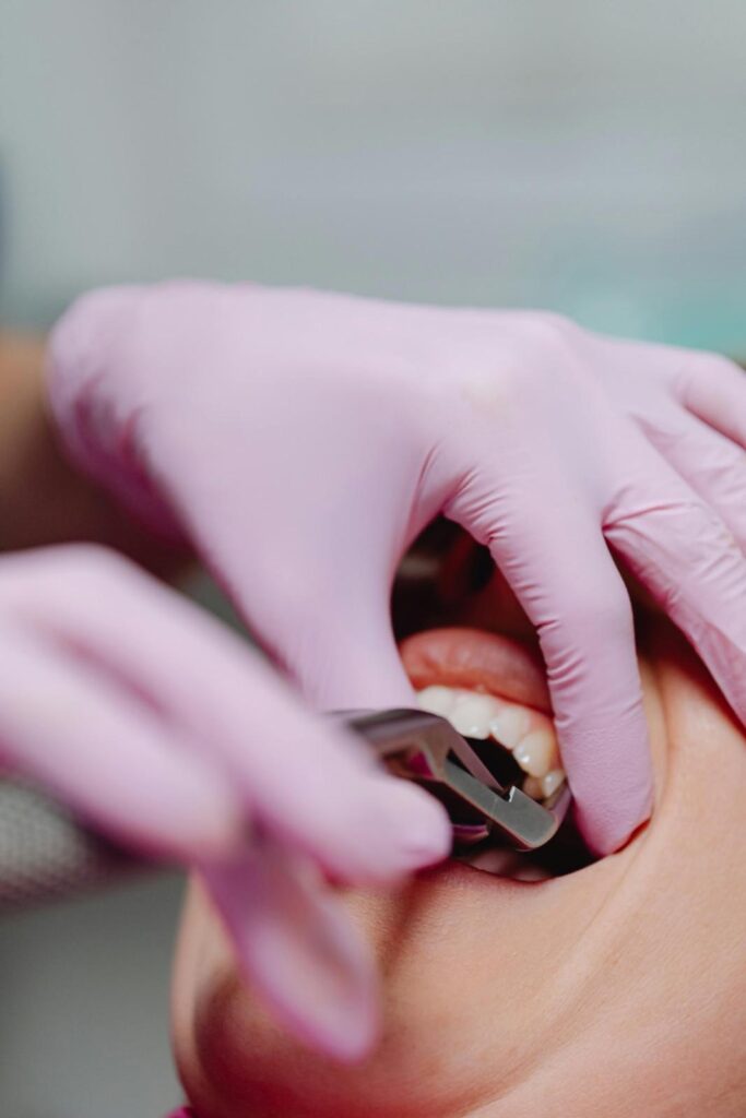 Restorative Dentistry in Millwoods