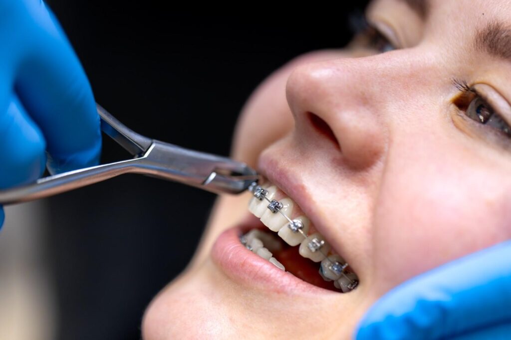 orthodontics in millwoods edmonton