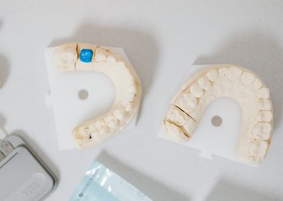 what is a dental crown and when is it needed