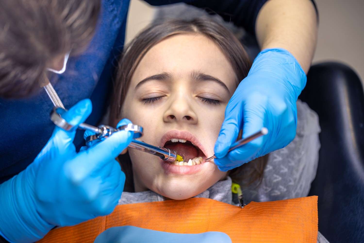 Dental Sealants for Kids