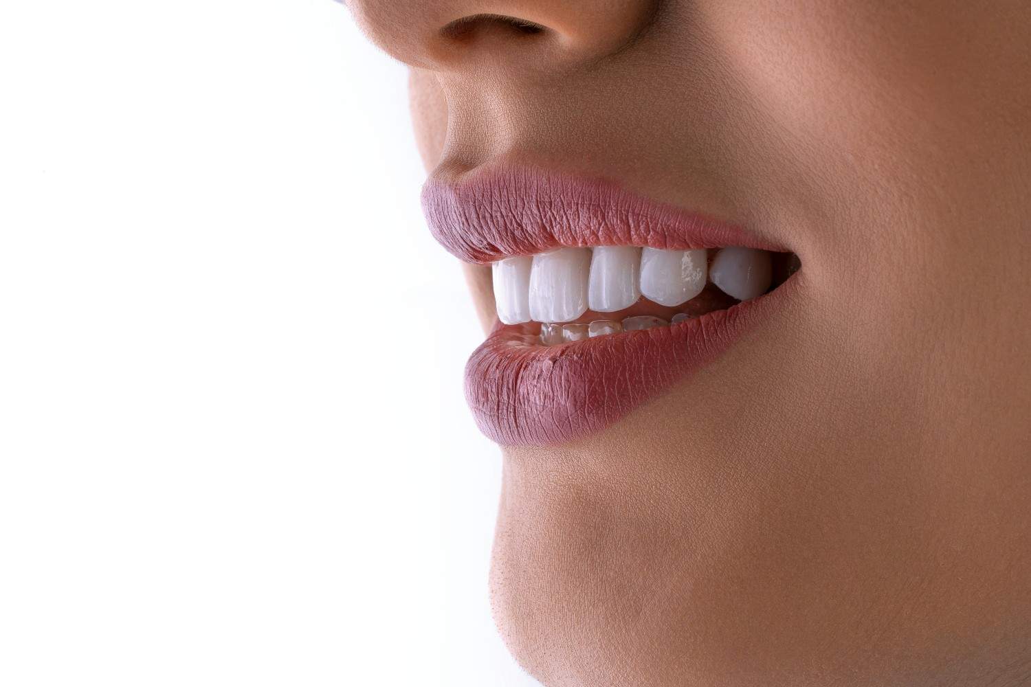 teeth whitening treatment millwoods